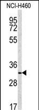 NQO1 Antibody (Center)
