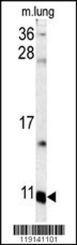S100A6 Antibody (C-term)