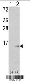 S100A6 Antibody (C-term)