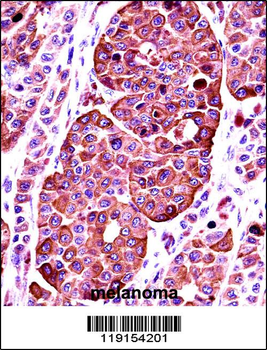 TYR Antibody (Center)