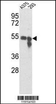 TYR Antibody (Center)