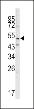 SMYD3 Antibody (N-term)