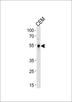 KLF5 Antibody (C-term)