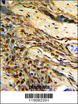 MGMT Antibody (C-term)