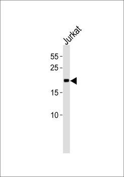 MGMT Antibody (C-term)