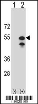 CPN1 Antibody (N-term)