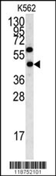 LYAR Antibody (N-term)