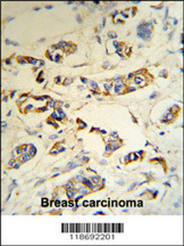 C1QA Antibody (C-term)