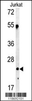 C1QA Antibody (C-term)