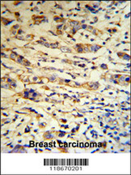 A1BG Antibody (C-term)