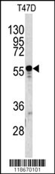 A1BG Antibody (C-term)