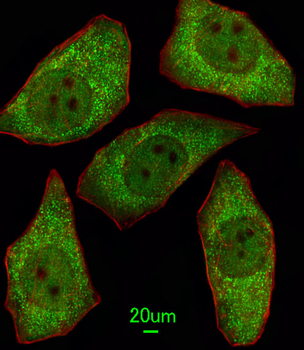 MSRA Antibody (N-term)