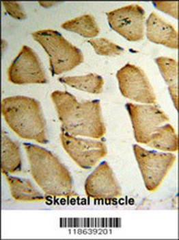 MFAP5 Antibody (C-term)