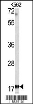 MFAP5 Antibody (C-term)