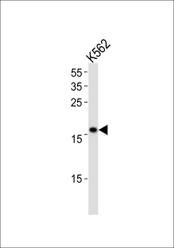 POLE3 Antibody (N-term)