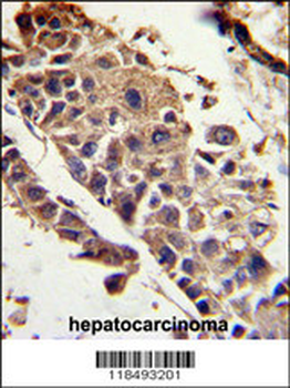 SERPINF1 Antibody (Center)