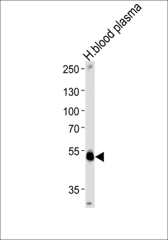 SERPINF1 Antibody (Center)