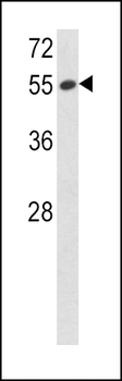 SERPINF1 Antibody (N-term)