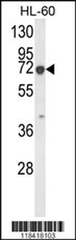 KRT9 Antibody (Center K317)