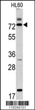 CAPN9 Antibody (N-term)