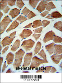 CA5B Antibody (C-term)