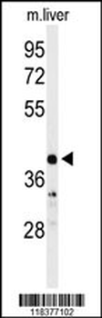 CA5B Antibody (C-term)