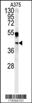CA14 Antibody (N-term)