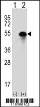 CA14 Antibody (N-term)