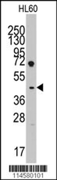 Lefty (LEFTB) Antibody (C-term)