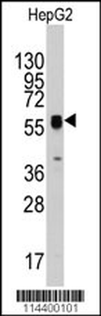 ECGF1 Antibody (Center)