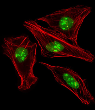 EN1 (Engrailed 1) Antibody (N-term)