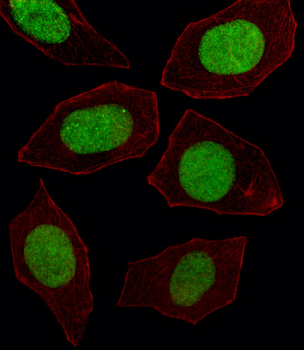EN1 (Engrailed 1) Antibody (N-term)