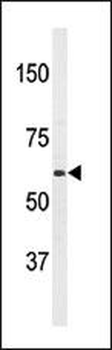 PAT1(APPBP2) Antibody (Center)