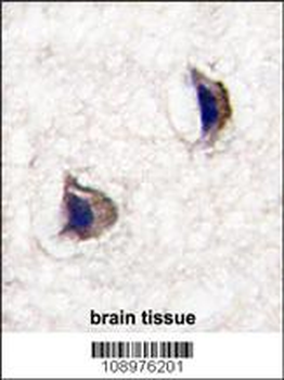 NP1(Nptx1) Antibody (Center)
