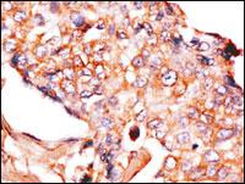 NP1(Nptx1) Antibody (Center)