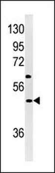 NP1(Nptx1) Antibody (Center)