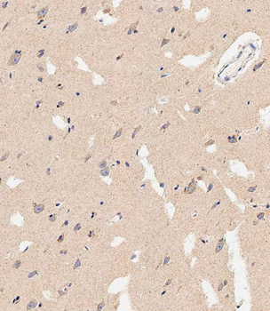 PHB2 Antibody (Y248)