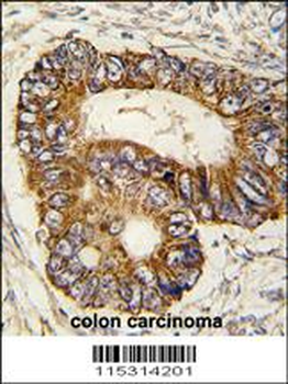 PHB2 Antibody (Y128)