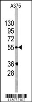 PIST Antibody (Center)