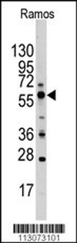PIST Antibody (C-term)