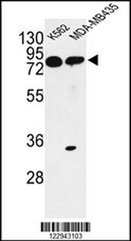 PRKAA1 Antibody