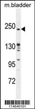 RICTOR Antibody (Center)