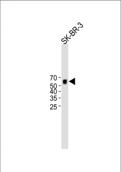 MYT1 Antibody (C-term)