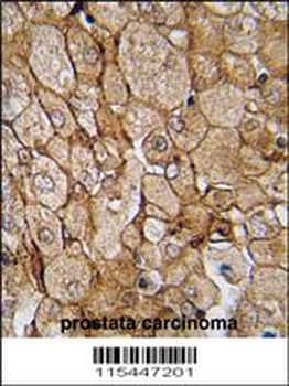 CAMK1G Antibody (Center K226)