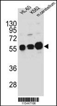CAMK1G Antibody (Center K226)