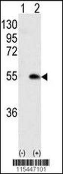 CAMK1G Antibody (Center K226)