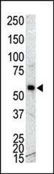 CAMK1G (CaMKI gamma) Antibody (C-term)
