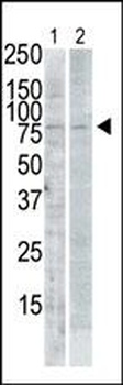 PLK2 (SNK) Antibody (C-term)