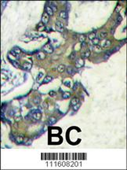 MAPK1 Antibody (C-term)