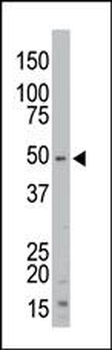 STK35 Antibody (Center)